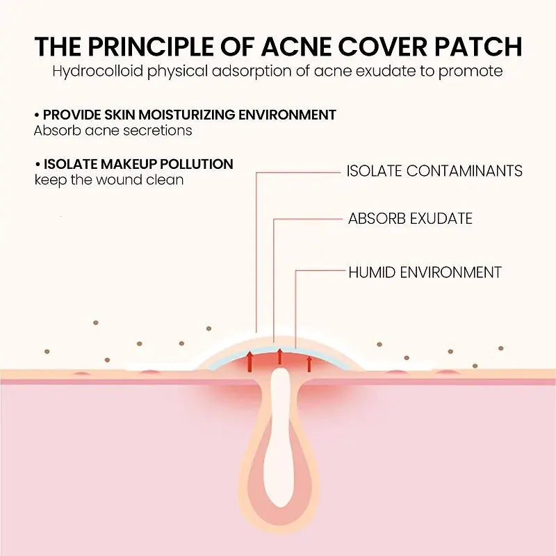 200pcs Pimple Patch | EcoGlow Essentials