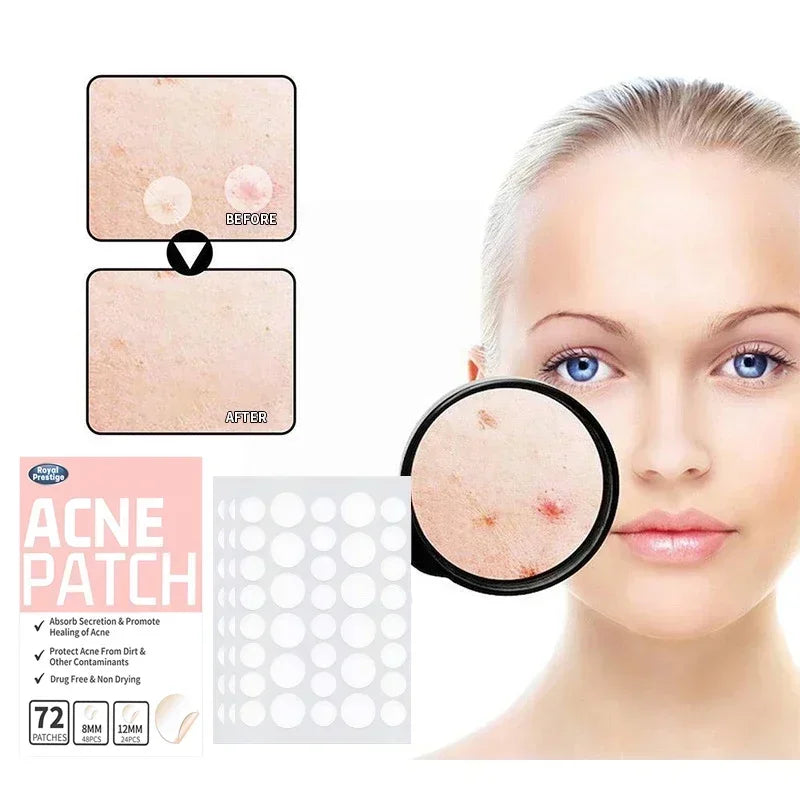 72/180Pcs Invisible Acne Patches| EcoGlow Essentials