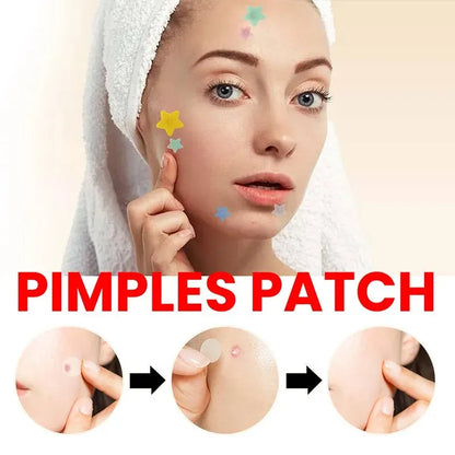 200pcs Pimple Patch | EcoGlow Essentials