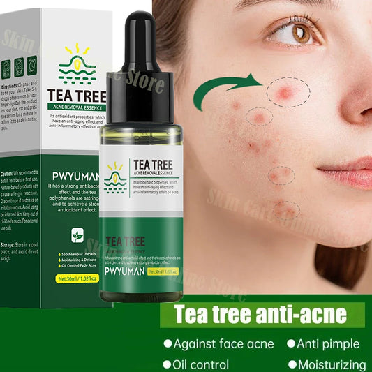 Tea Tree Acne Removal Serum | EcoGlow Essentials