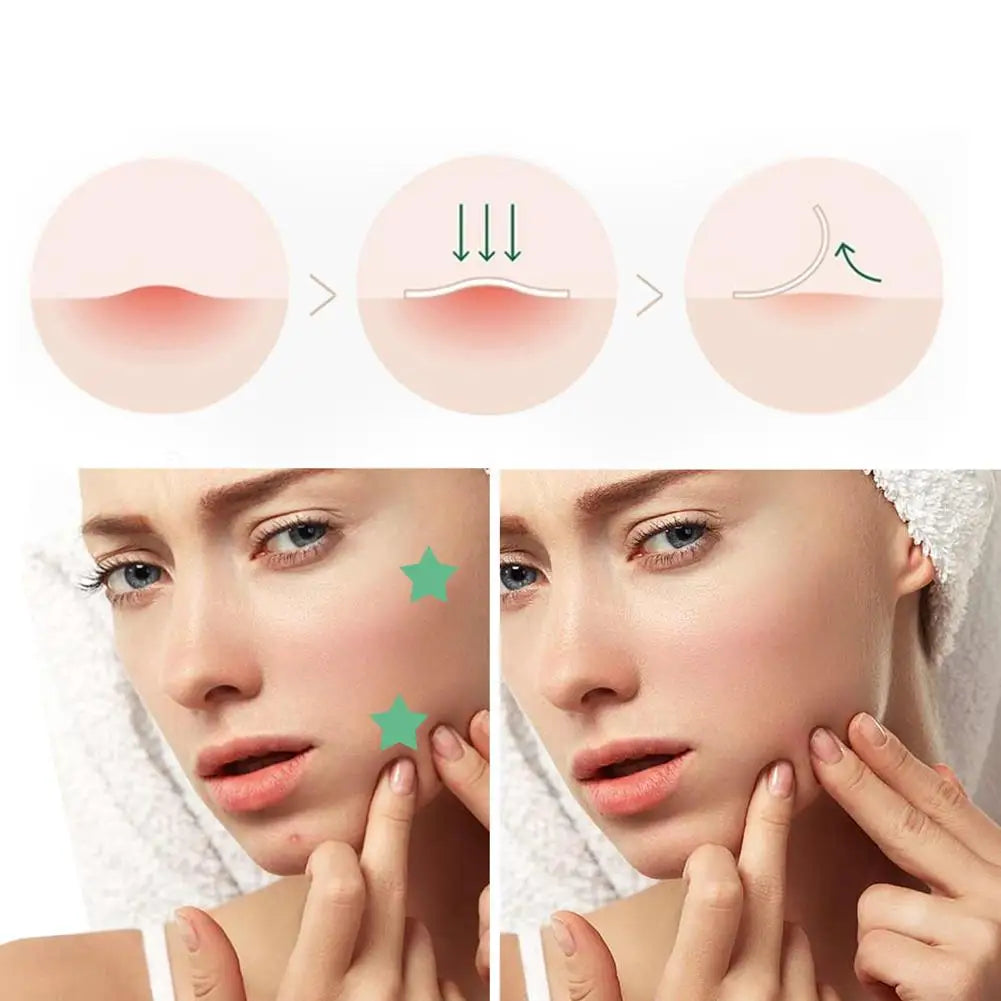 300/600pcs Invisible Acne Patch| EcoGlow Essentials